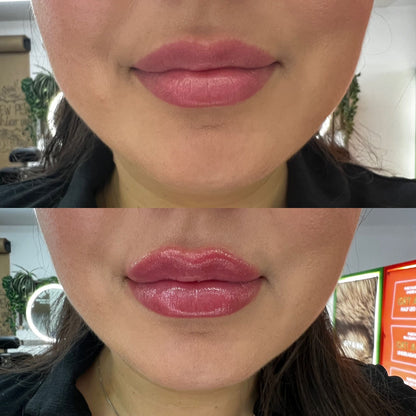 Plump It! No Needles Lip Filler Kit